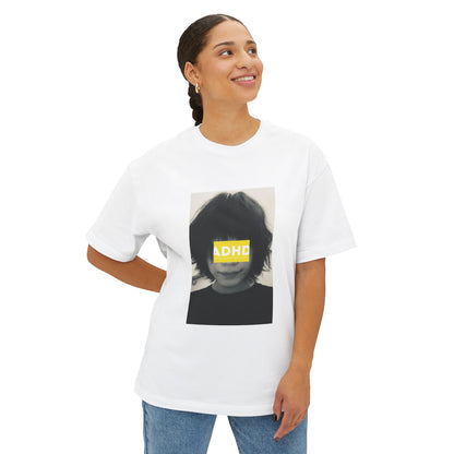 White ADHD Oversized Tee (Forgetfull Yellow)